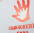 Девочке с генетическим заболеванием требуется помощь горожан - VTomske.Ru